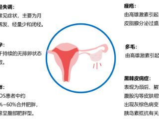 多囊不止妇科病，多维度深入解析与解读